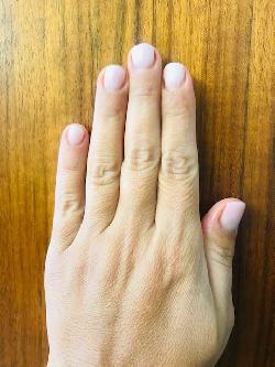 Bild: Naturnagelverstärkung mit Gel